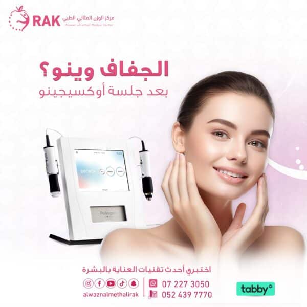 الجفاف وينو بعد جلسة اكسجينو 600x600