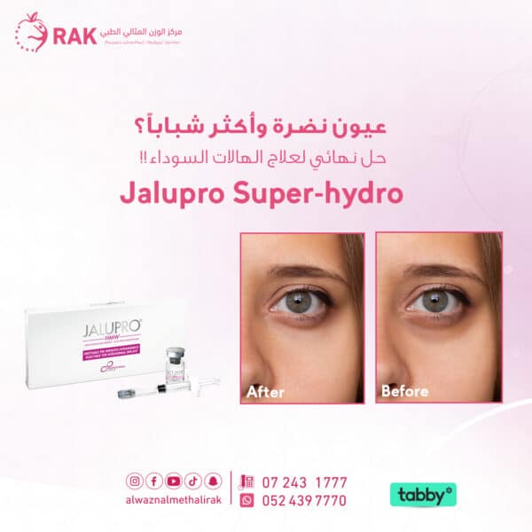 Jalupro Super hydro jpg2 600x600
