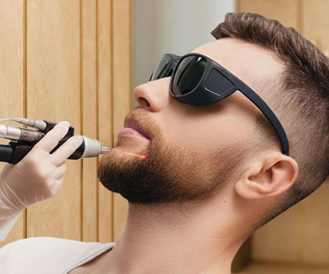 قسم-إزالة-الشعر-بالليزر قسم-إزالة-الشعر-بالليزر
